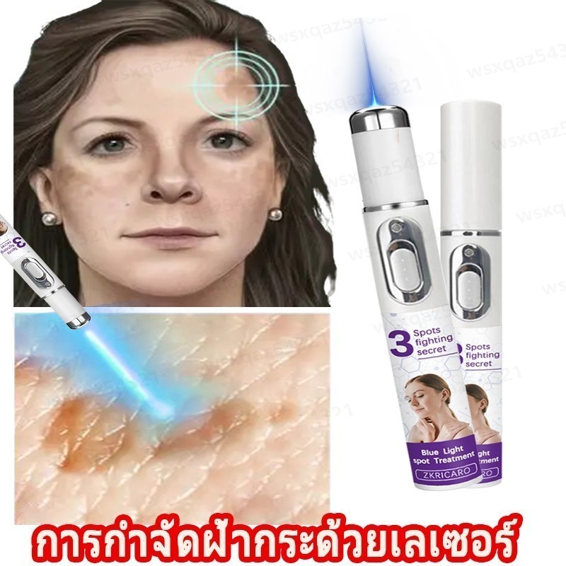 ปากกาเลเซอร์แบบพกพาปรับปรุงฝ้ากระสว่างขึ้นกระและลดจุดด่างดําและเม็ดสีได้อย่างมีประสิทธิภาพ - รูปที่ 4