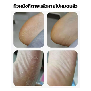 💥สุดคุ้มจริงๆ💥【 รุ่นล่าสุด เครื่องขัดส้นเท้าไฟฟ้า】เครื่องซ่อมส้นเท้า/กำจัดผิวหนังด้าน/ซ่อมแซมส้นเท้าแตก/ให้นุ่มเรียบเนียน เหมาะสำหรับทุกคนในครอบครัว/ปลอดภัย-ไร้เจ็บปวด-ใช้งานง่าย