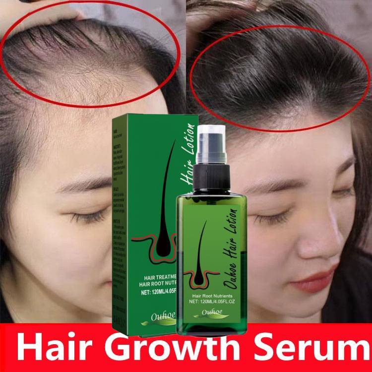 Ginger Hair Spray Hair Oil Anti-Hair Loss Hair Care Growth Essence Spray 120ml