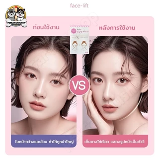 เทปดึงหน้า สติ๊กเกอร์หน้าเรียว แผ่นสติกเกอร์แปะหน้าเรียว V-Shape ยกกระชับใบหน้า ปรับรูปหน้า
