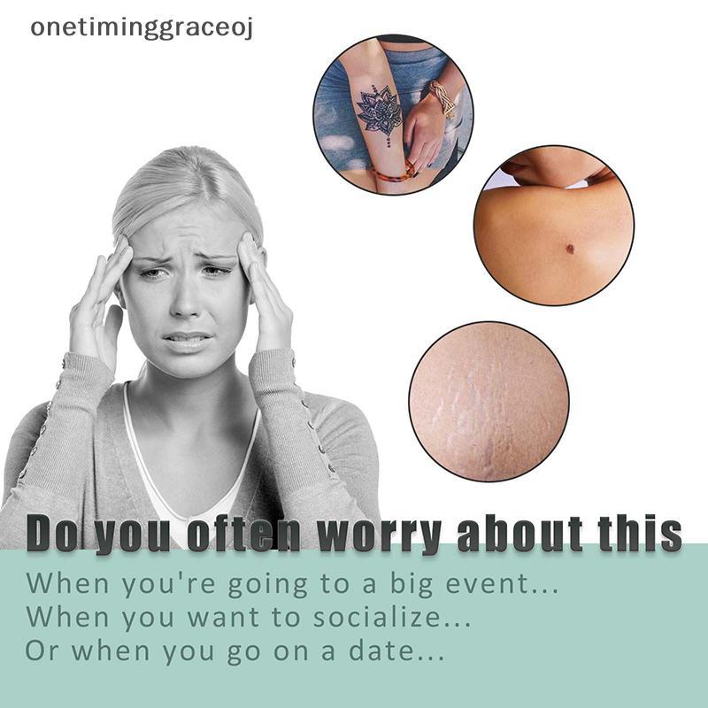 Onetiminggraceoj สติ๊กเกอร์รอยสักคอนซีลเลอร์ Cover Up Scar Birthmark Patch Tape (60-100 ยูนิต) CEJ