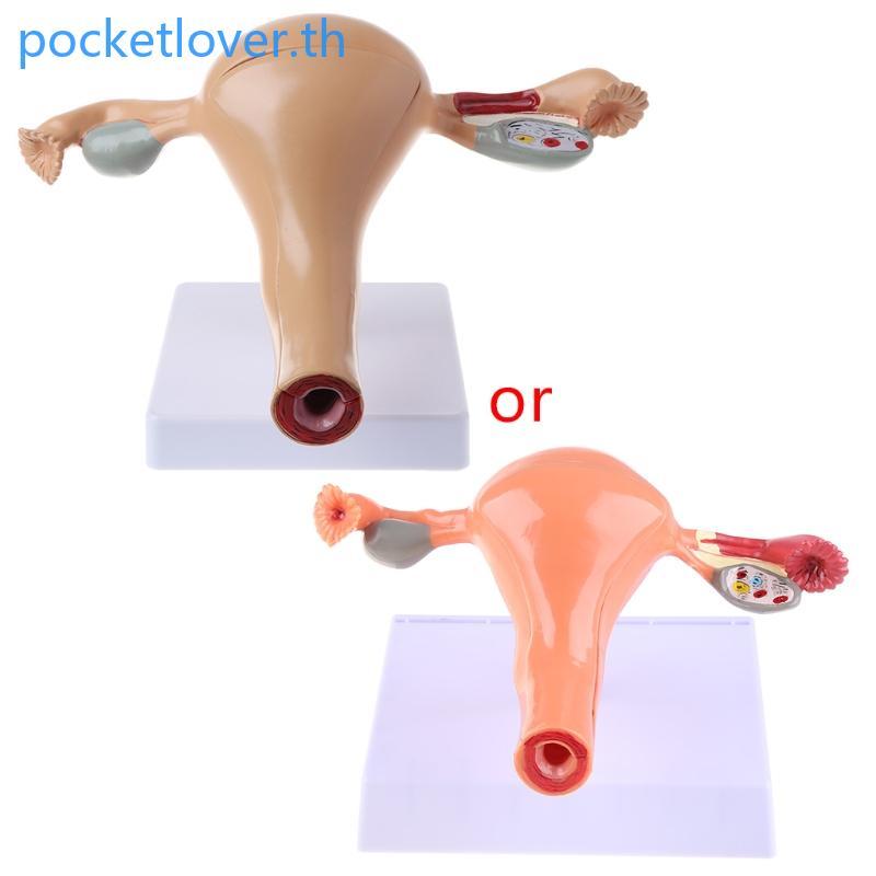 Poc Human Pathlogical มดลูก Ovary รุ่นกายวิภาคศาสตร์โรคพยาธิวิทยา Medic