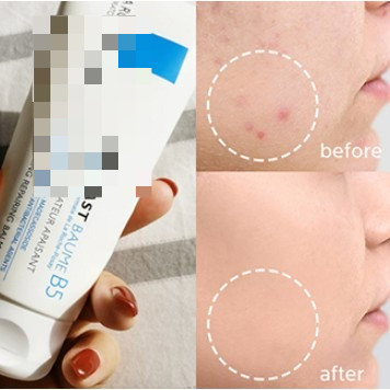 ครีมซ่อมแซม B5 รุ่นใหม่ 100ml