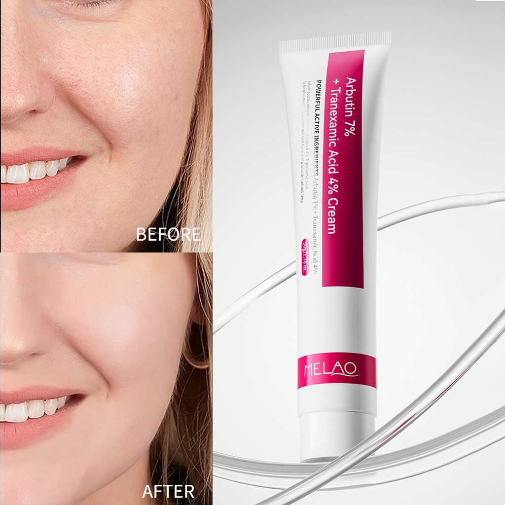 [คลังสินค้าพร้อม] 7% Arbutin Tranexamic Acid Cream Whitening Fade Coloring Moisturizing Arbutin Crea