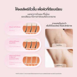 Dreame Sapphire IPL Hair Removal 21J เครื่องเลเซอร์กำจัดขนแบบ IPL Ice-Cooling 8 ระดับ ปกป้องผิวจากความร้อน