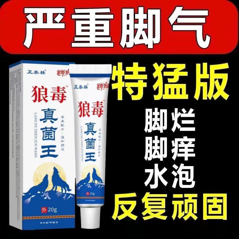 New Product#Wolf Poison Athlete's Foot King Athlete's Foot Wolf Poison Fungus King Foot Odor Itchy F