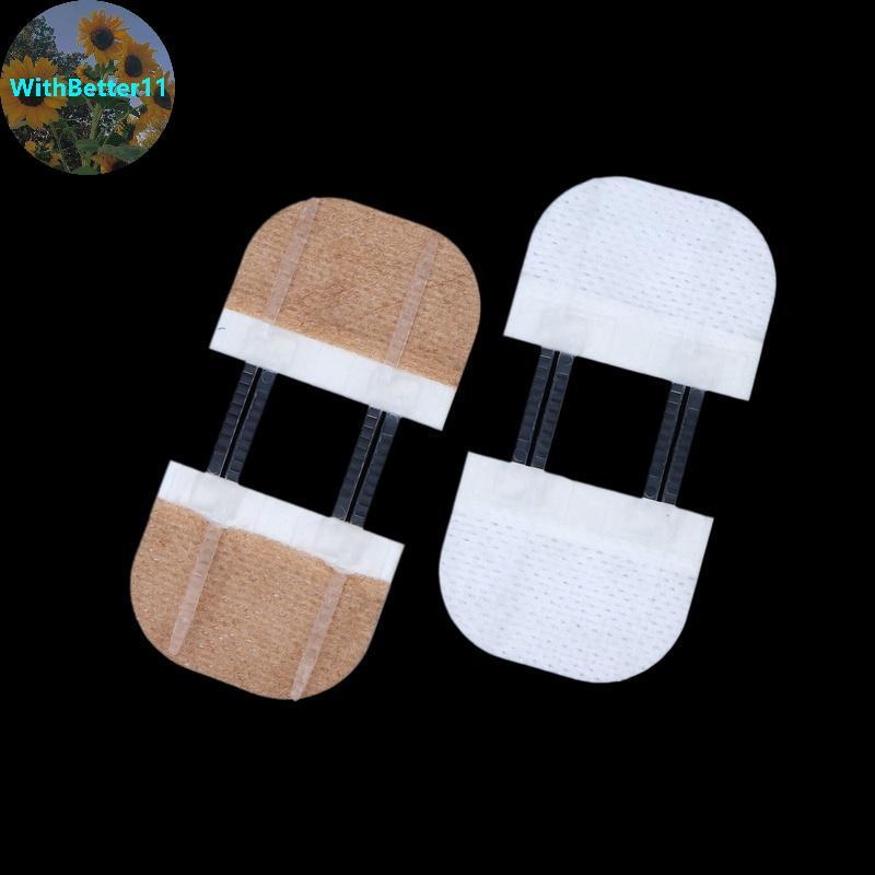 ดีกว่าซิป Tie Wound ปิด Patch Hemostatic Patch Wound Fast ไม่มีเย็บซิปกลางแจ้ง Band-Aid แบบพกพา Qui 