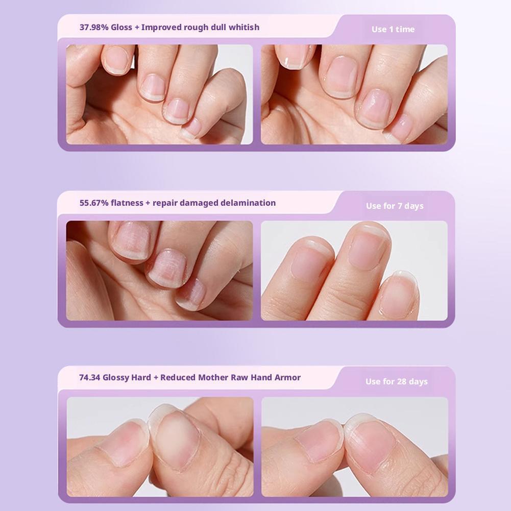 เล็บโภชนาการน้ํามันปากกา Cuticles Revitalizer Oil Nail Care 3.5ml Nail Care J8u4
