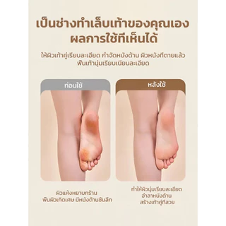 💥สุดคุ้มจริงๆ💥【 รุ่นล่าสุด เครื่องขัดส้นเท้าไฟฟ้า】เครื่องซ่อมส้นเท้า/กำจัดผิวหนังด้าน/ซ่อมแซมส้นเท้าแตก/ให้นุ่มเรียบเนียน เหมาะสำหรับทุกคนในครอบครัว/ปลอดภัย-ไร้เจ็บปวด-ใช้งานง่าย