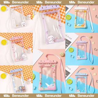 ซองกันน้ำโทรศัพท์ลายสก๊อตติช พิมพ์ลายสุดน่ารัก เหมาะเล่นสงกร…