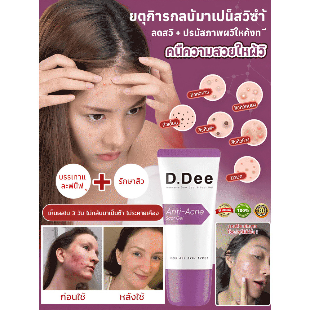 ของแท้💯เจลแต้มสิว 【บรรเทาและฟื้นฟู】สูตรเฉพาะดูแลผิวตรงจุด รอยสิวจางลงเร็วทันใจ ทั้งสิวอุดตัน สิวหัวช้าง สิวผด แต่งหน้าได้ไม่เป็นก้อนขาว ควบคุมความมัน ลดการอักเสบ ผิวเด้งใสไร้รอยดำ