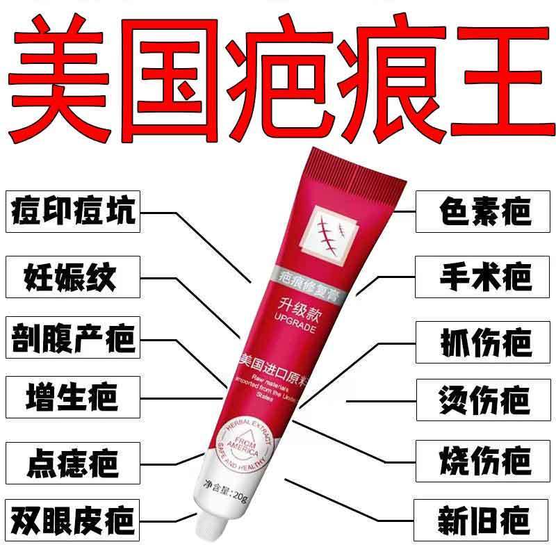 2026 สินค้าใหม่ ใหม่ Scar Old Scar Removal Cream No Mark Removal Scar Growth Acne Mark Repair Scar R