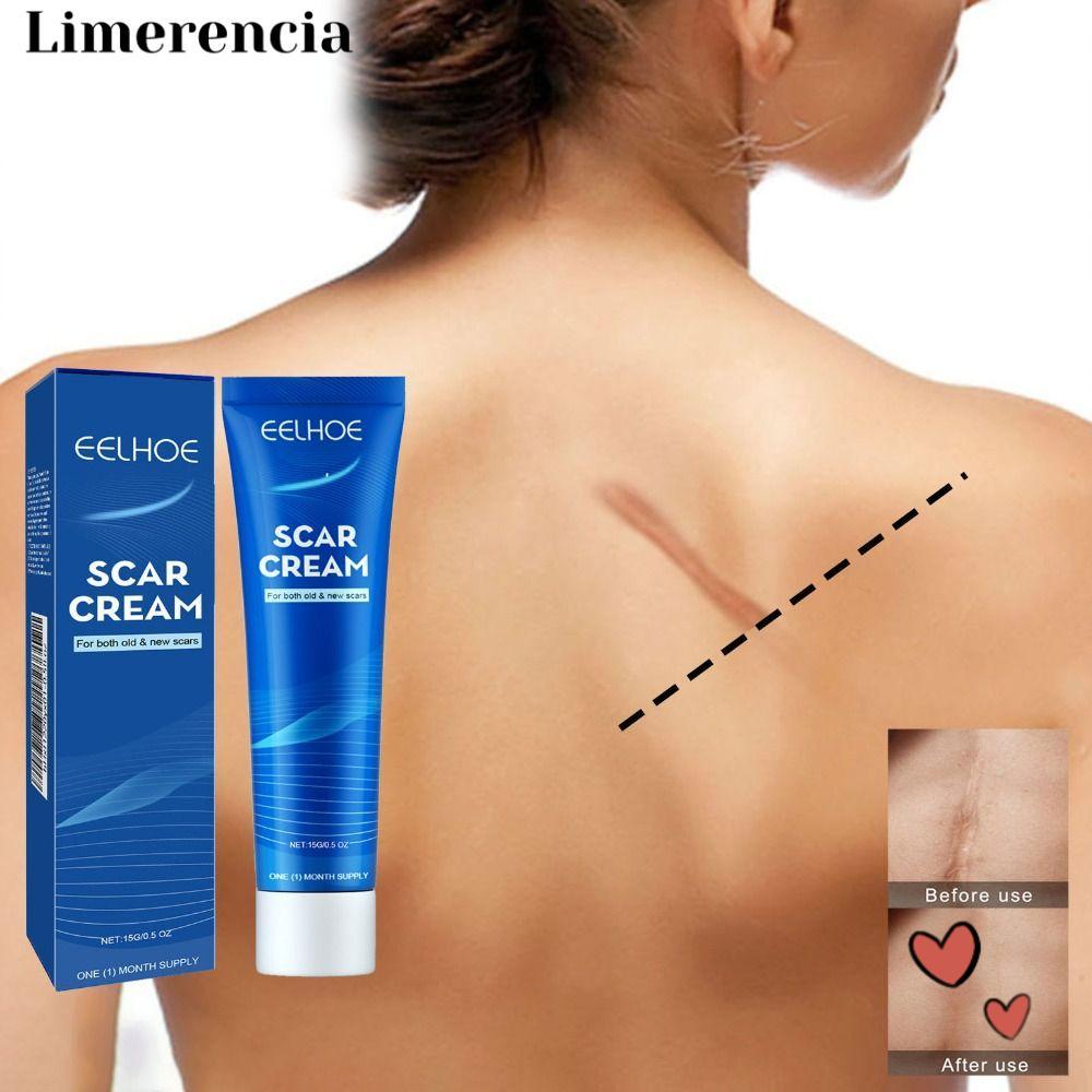 LIMERENCIA Scar Gel, Gentle Moisturizing Smoothing Scar Cream, ครีมบํารุงผิวสกัดพืชธรรมชาติบริสุทธิ์