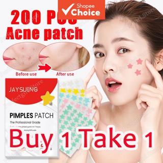 แพทช์ 200 ดาวรูปสิวแพทช์สิวใบหน้าผิวจุดรักษาสติกเกอร์สําหรับ…