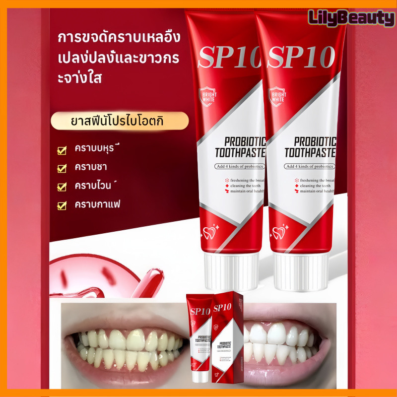 Toothpaste SP10 ฟอกฟันขาวทันใจ ลดกลิ่นปาก ดูแลช่องปาก Whitening Toothpaste ลดหินปูน เหนือกว่าการขูดห