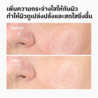 The Ordinary Alpha Arbutin 2% + HA 30mL | เซรั่มลดจุดด่างดำ ผิวกระจ่างใส สีผิวสม่ำเสมอ เรียบเนียน