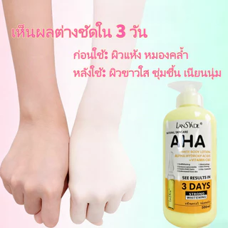 ผิวขาว Body Lotion กรดผลไม+VC&E คลีมทาผิว โลชั่นผิวขาว ทาผิวขาว ผิวขาวใส ฟื้นฟูผิวแห้งเสียให้อิ่มน้ำ 500ML