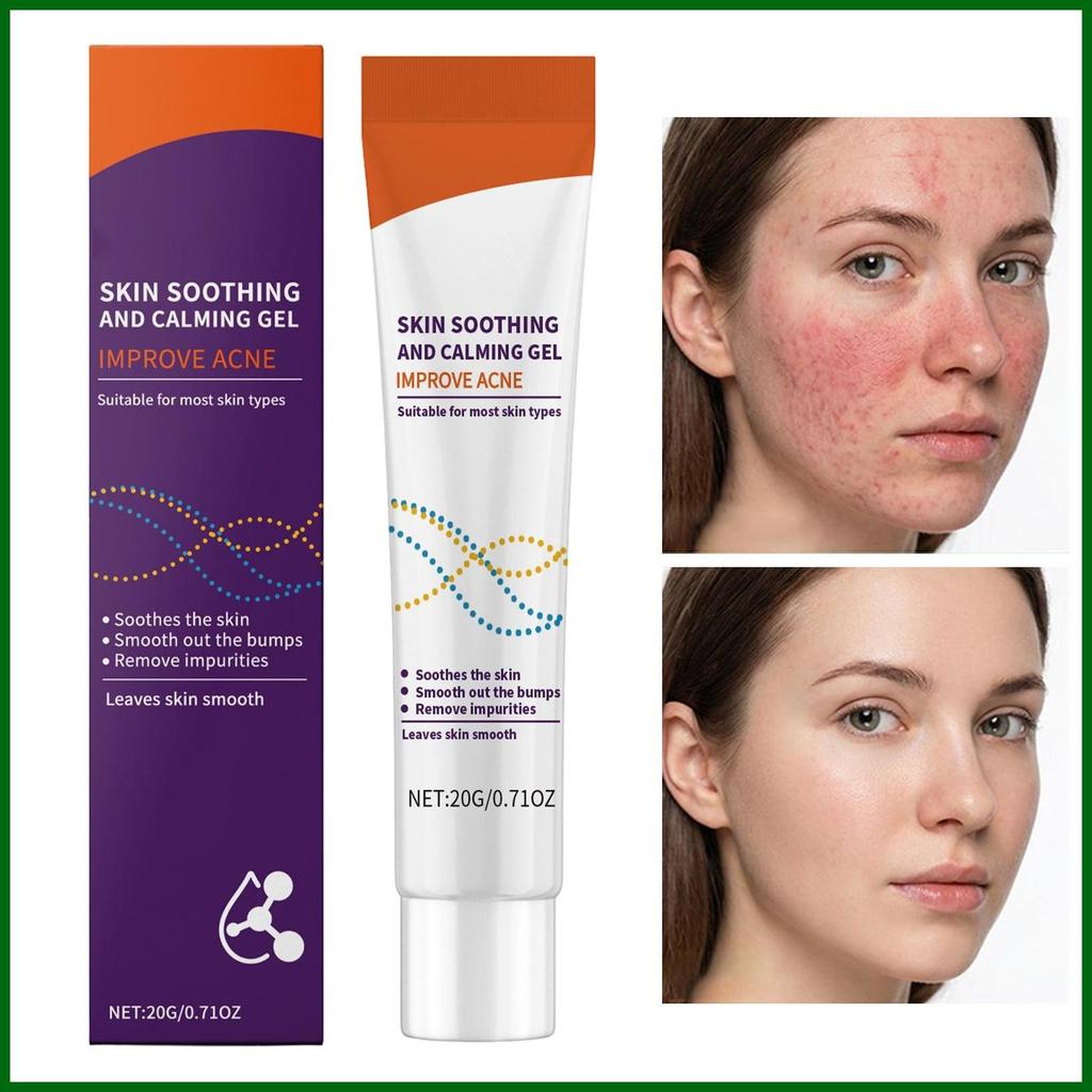 ครีมให้ความชุ่มชื้นบนใบหน้า Hydrating Non-Greasy Facial Pimple Remover Gel Face Pimple Remover ครีมส