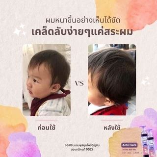 AchiHerb อชิเฮิร์บ แชมพูสระผม ครีมนวดผม เซรั่ม สารสกัดธรรมชาติ เพื่อผมที่ดูสวย เงางาม ใช้ได้ตั้งแต่แรกเกิด ถึง ผู้ใหญ่
