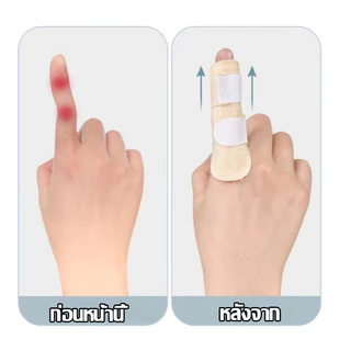 เฝือกดามนิ้ว เฝือกดามนิ้วเสริมแกนแข็ง ลดการขยับงอนิ้ว พยุงนิ้วมือ ระบายอากาศ บรรเทาอาการปวดนิ้วหัวแม่