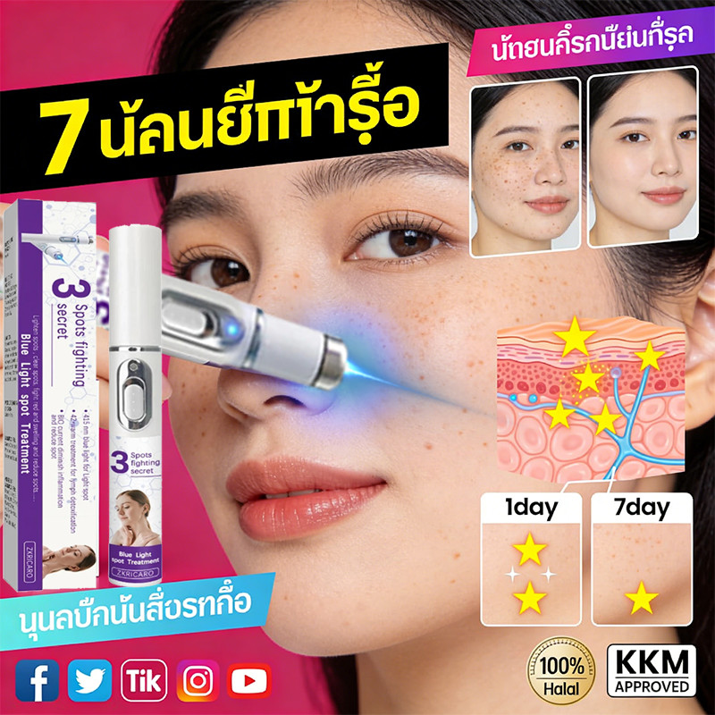 ปากกากําจัดฝ้ากระเลเซอร์ในครัวเรือนบํารุงผิวอ่อนโยนเหมาะสําหรับทุกวัยทุกวันใช้ในบ้านลดฝ้ากระบนใบหน้า