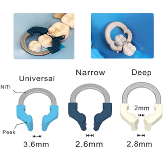 Dental Clamp Ring Sectional Contoured Matrix System Nickel Titanium Matrix Band แถบแมททริกซ์ทันตกรรม NITI แมททริกซ์โลหะ