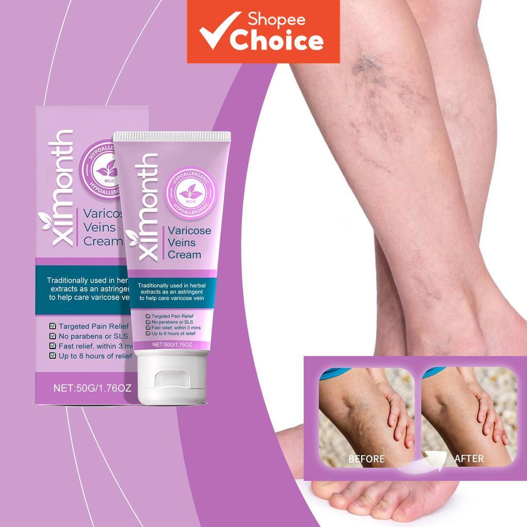 Ximonth ครีมสนับสนุนเส้นเลือดดํา 50กรัม บาล์มขาสําหรับเส้นเลือดขอดเพื่อบํารุงและดูแลขาอย่างมืออาชีพ