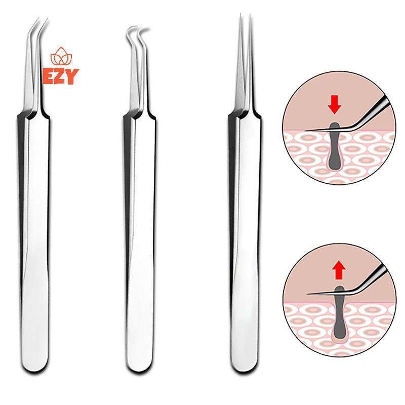 EZY 8 ซม.เซลล์สิวแหนบร้านเสริมสวยพิเศษขูดปิด Artifact เครื่องมือใหม่