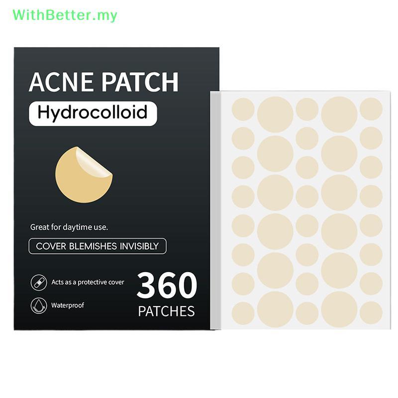 ด้วยดีกว่า 360PCS สิว Patch สิวที่มองไม่เห็น Skin Care สติกเกอร์คอนซีลเลอร์ Face Spot เครื่องมือแต่ง