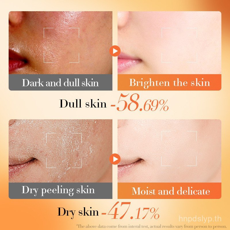 BIOAOUA Vitamin E B5 Moisturizer Cream Multi Repair Hydrating Nourishing Face Cream Brightening Skin