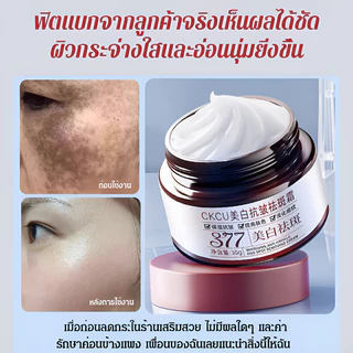 【ทาปุ๊บลดจุดด่างดํา】ครีม 377 ลดริ้วรอยและจุดด่างดํา บํารุงผิวกระจ่างใส แก้ฝ้า กระ จุดด่างดํา 30g