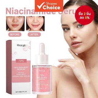 เซรั่มบํารุงผิวหน้าไนอะซินาไมด์ กําจัดจุดด่างดํา ผิวขาวกระจ่…