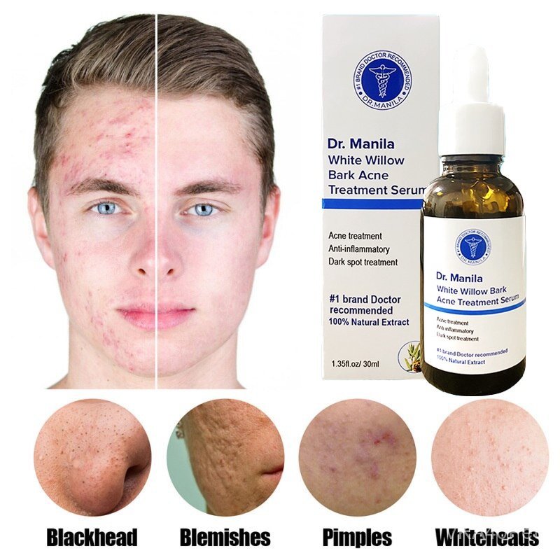 Dr.Manila - Acne Treatment Serum White Willow Bark( Authentic )
