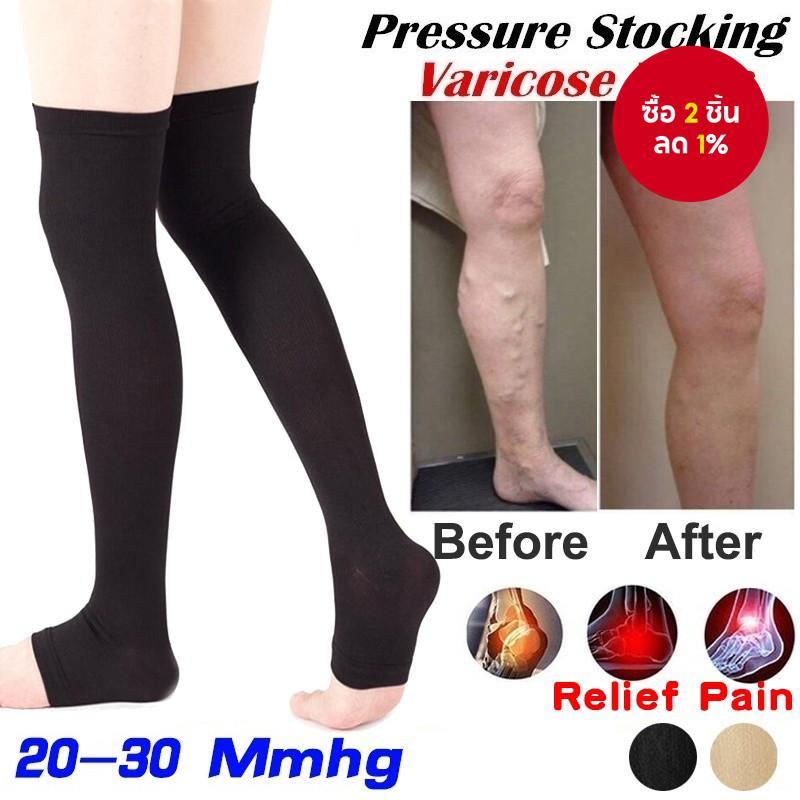ถุงน่องแบบกดทับสูงถึงต้นขา 20-30mmHg - ช่วยรองรับขาแบบเปิดนิ้วเท้า เพื่อลดการบวมและปรับปรุงการไหลเวียน (สีดำ/สีเนื้อ)