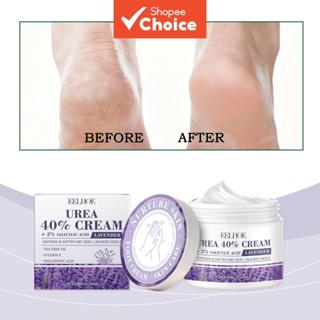 ครีมทามือและเท้า Urea 100g - ผสมกรดซาลิไซลิก วิตามินอี และกร…