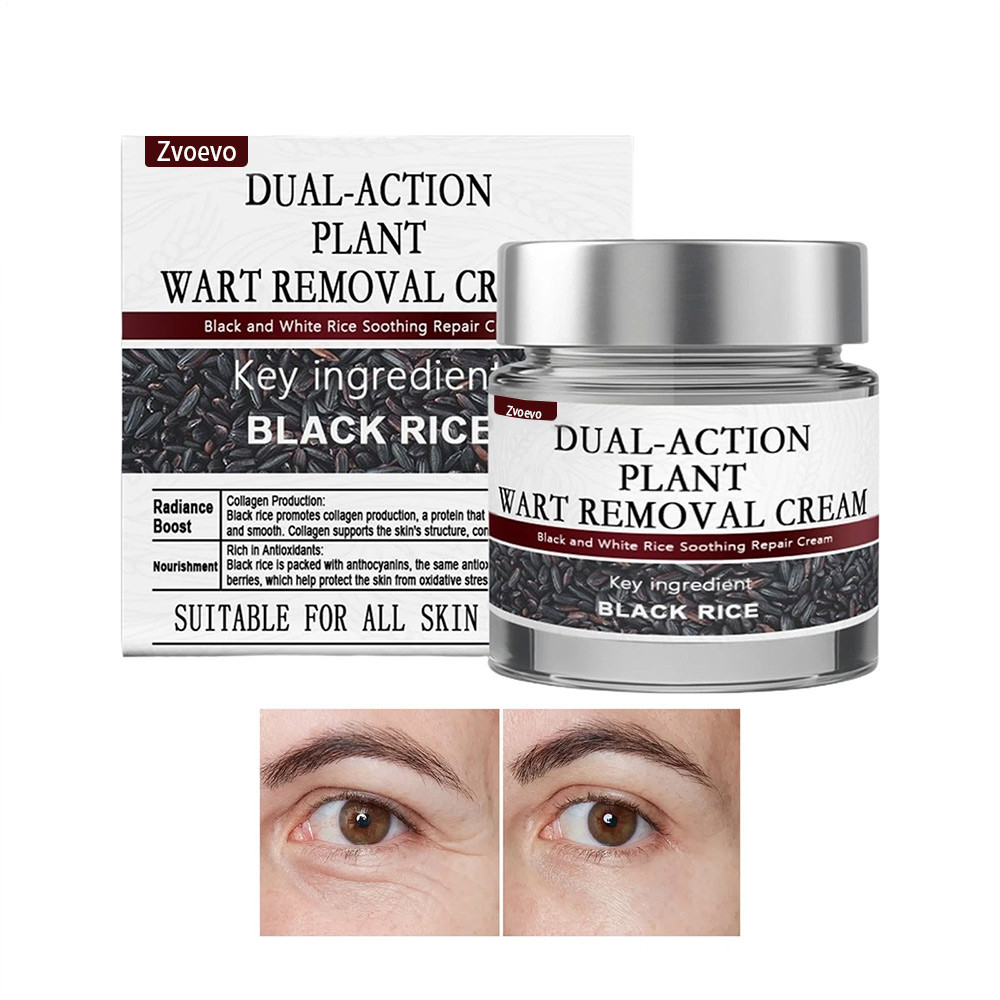 Black Rice Skin Repair Essence Cream Dual Action Plant Wart Removal Cream