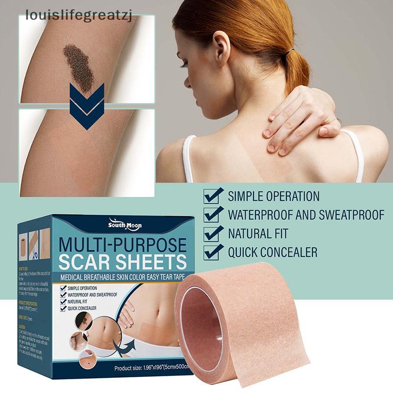 LFG 1 ม้วนสีผิวโทนคอนซีลเลอร์ Tattoo Stiers Cover Up Tattoo Burn Scar Birthmark ที่มองไม่เห็น Patch 