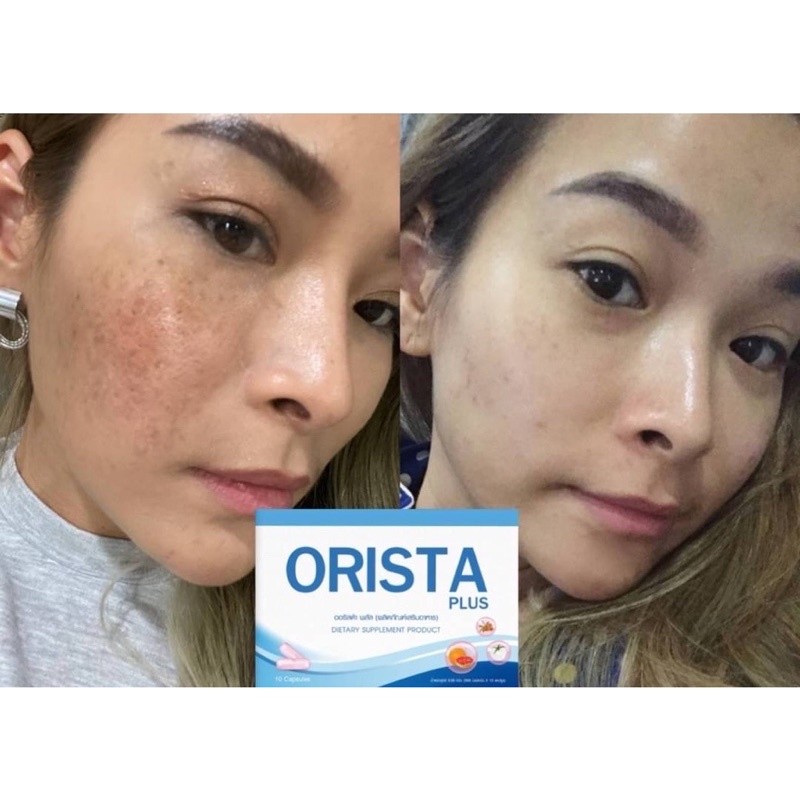 ⚡️ของแท้⚡️ถูกสุด⚡️ลดจัดหนัก⚡️โฉมใหม่ Orista Plus : วิตามิน ออริสต้า พลัส  1 กล่อง 10 แคปซูล