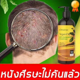 แชมพูขจัดรังแค 500MLยาสระผมเชื้อรา ป้องกันรังแคและลดความมัน บำรุงหนังศรีษะ ลดอาการคันศีรษะ ลดรังแค แชมพูขจัดรังแค