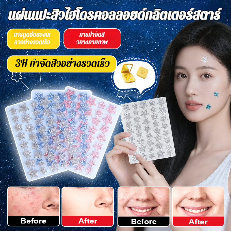 【24ชม.ลดรอยแดง】JMY Hydrocolloid แผ่นแปะสะเก็ดดาว/อุดตัน/แผลเป็น/แปะไร้รอย/ดูดสิวเร็ว