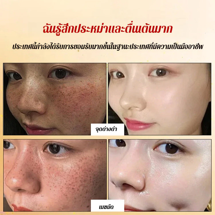 YH สเปรย์เซรั่ม Whitening Serum ลดฝ้า ลดจุดด่างดำ thumbnail 5