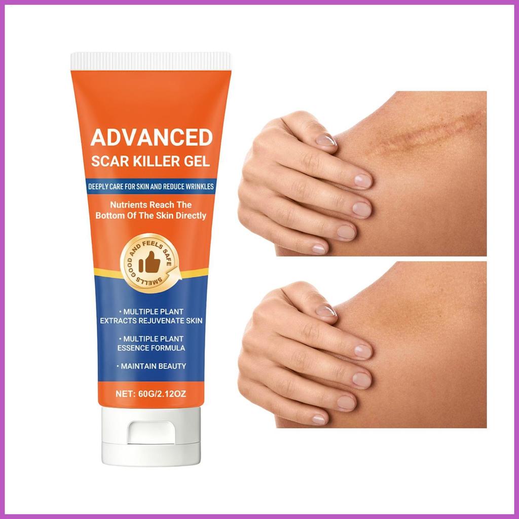 รอยแผลเป็นเจลสําหรับใบหน้ายืด Mark Soothing Supplies Skin Mark Soothing Gel สําหรับเศษผู้หญิงผู้ชายค