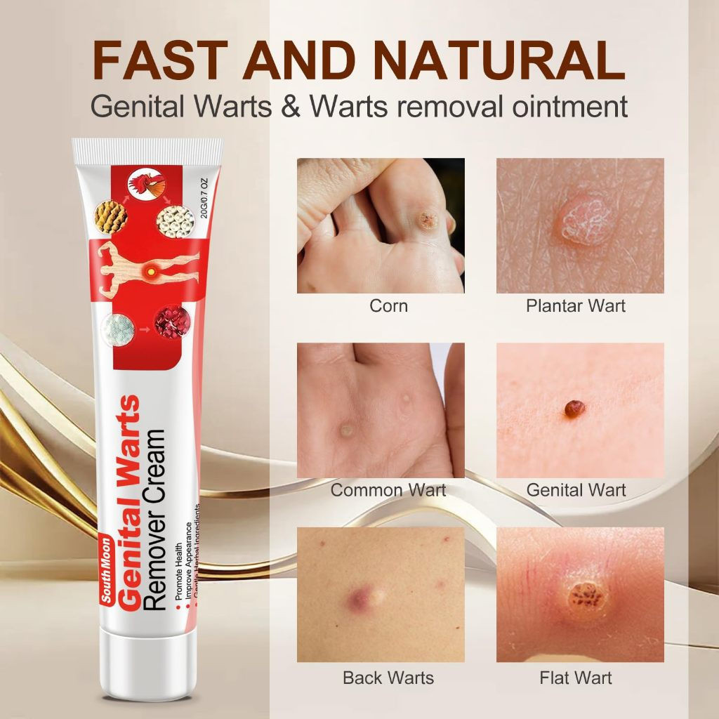 WS81 20g Fast-acting Gel Wart Removal Cream, Genital, ลบข้าวโพดบนเท้า, แคลลัสบนแต่เพียงผู้เดียว, ทั่
