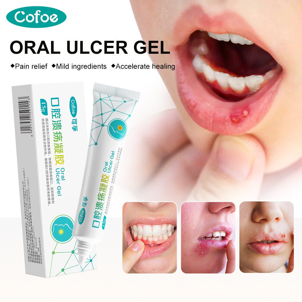 Cofoe Medical Oral Ulcer Antibiotic Gel Mouth Touchy Gums Sore Swollen Ulcers Treatment Relief Cream