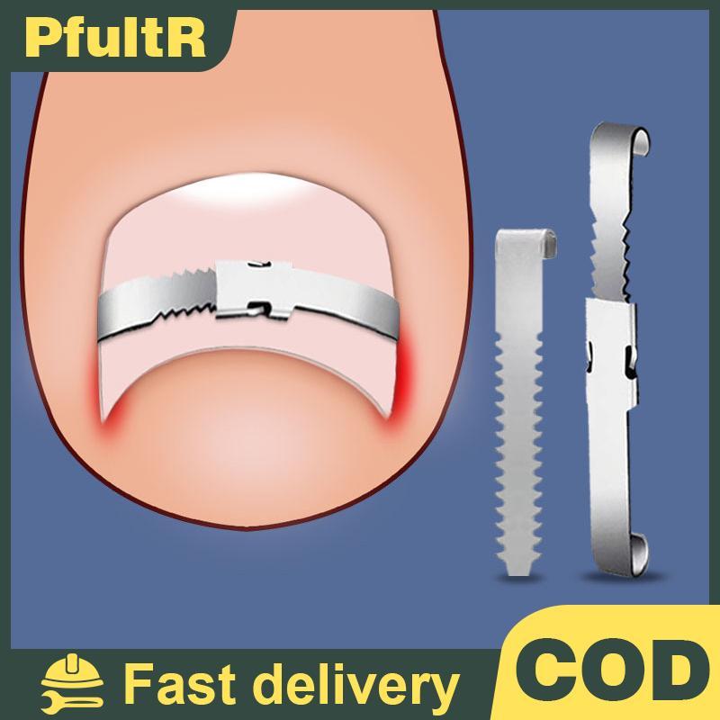 Null Toenail Corrector เครื่องมือ Professional คุด Toe Nail Treatment เครื่องมือ null