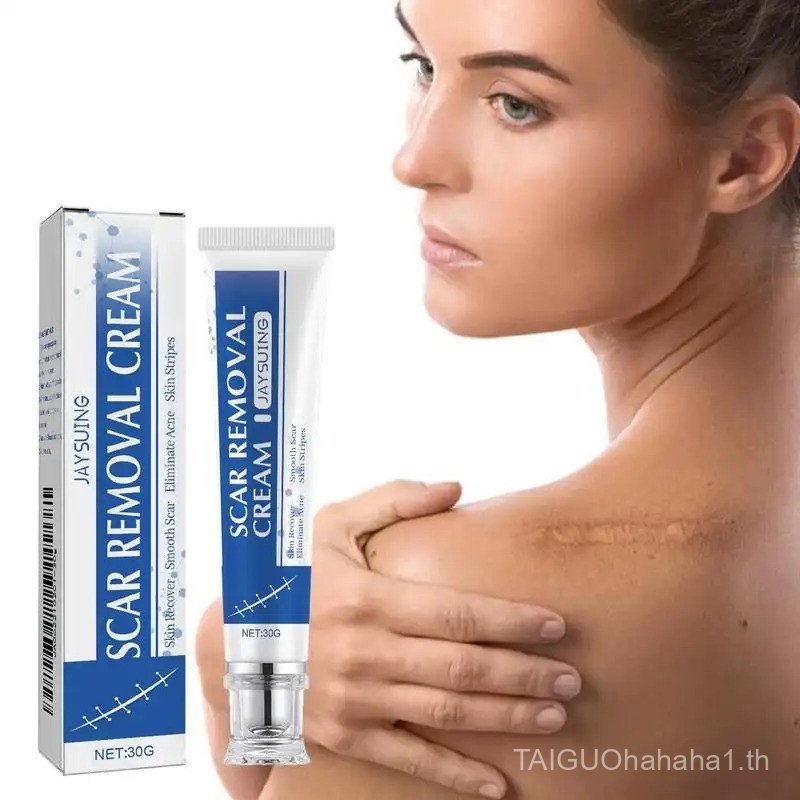 Scar Cream, Scar Removal Cream, Scar Care Cream, Skin Care Product for Women & Men, Maternity Scar A