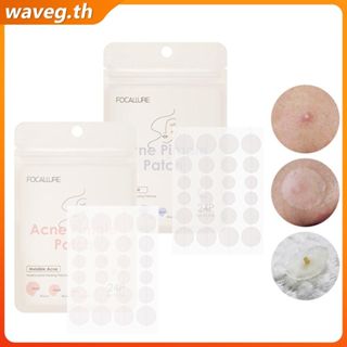 แผ่นแปะสิวใส FOCALLURE, แผ่นแปะสิวแบบมองไม่เห็น Focus Invisi…