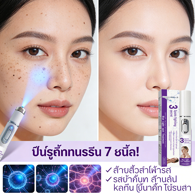 ปากกาเลเซอร์แบบพกพาปรับปรุงฝ้ากระสว่างขึ้นกระและลดจุดด่างดําและเม็ดสีได้อย่างมีประสิทธิภาพ