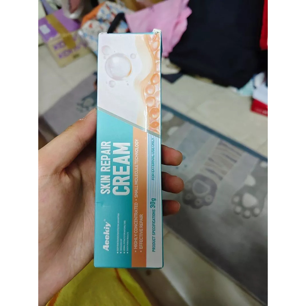 Aeekiy Sensitive Skin Cream: Hormone-Free Relief for Eczema, Tinea & Red, Itchy Skin