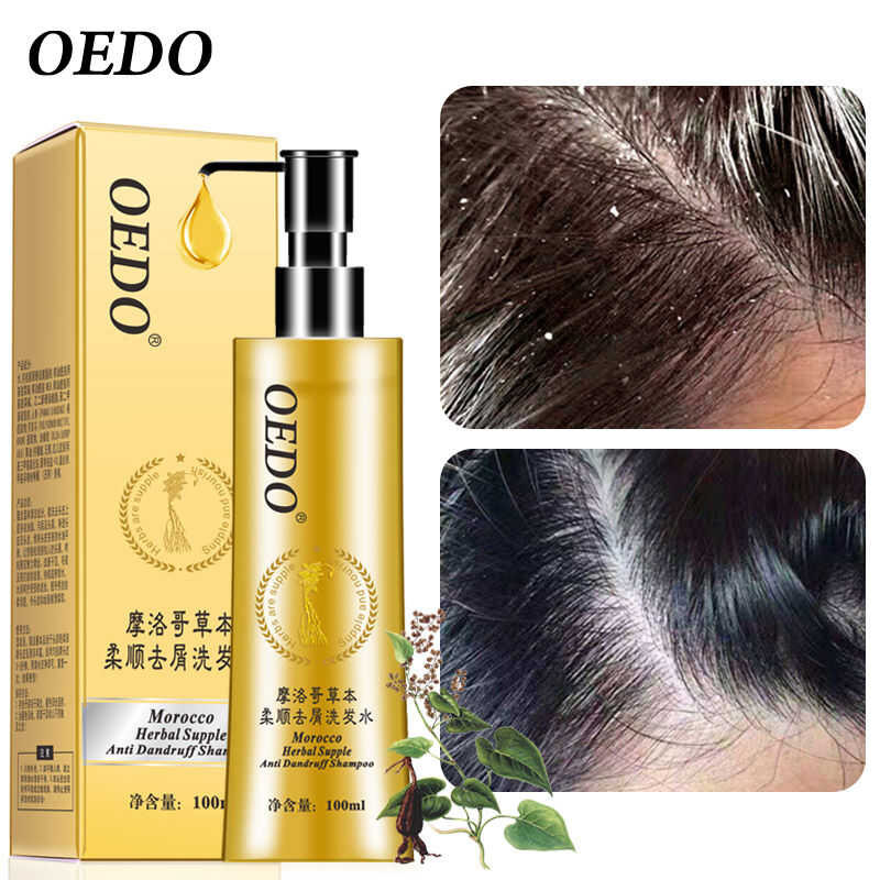 ▣ OEDO แชมพูขจัดรังแค ยาสระผมรังแค แชมพูสระผม ดูแลผม